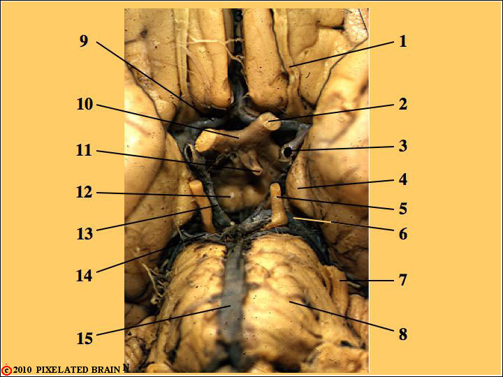  Ventral view of the Gross Brainstem 
