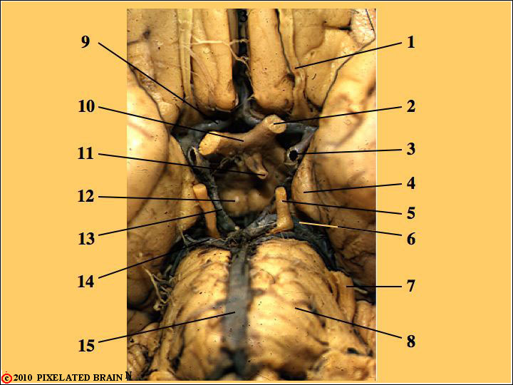 Ventral View of the Gross Brainstem Ventral View of the Gross Brainstem