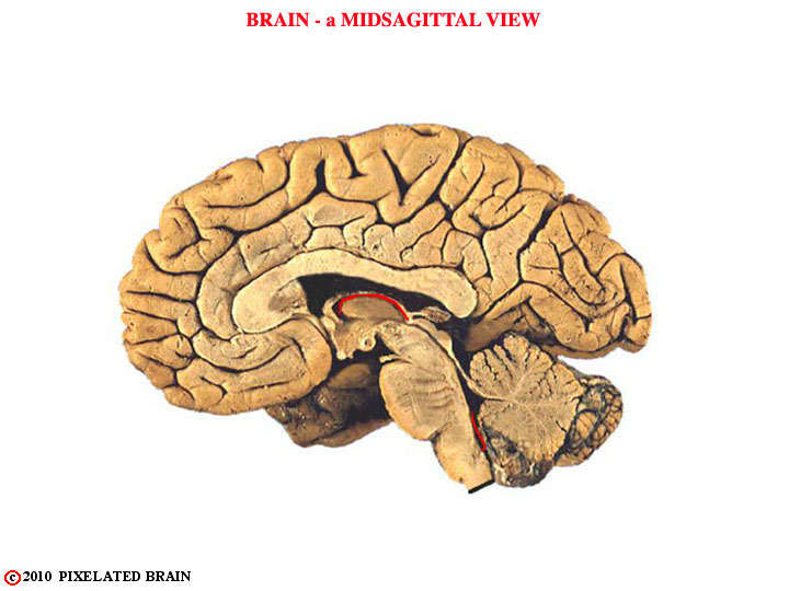  gross brain, midsagittal 