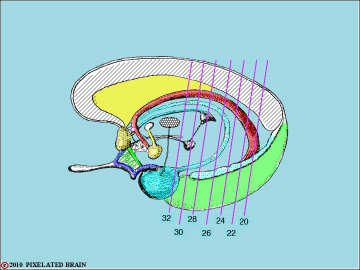 Pixelated Brain: Neuroanatomy for Medical Students