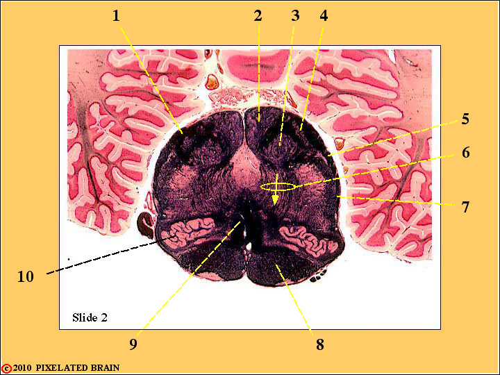CrossSection through the Caudal Medulla CrossSection through the Caudal Medulla