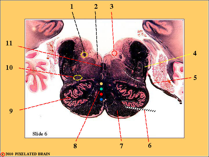  Slide 6 - the mid Medulla 