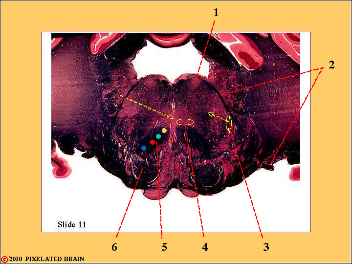 CrossSection through the Caudal Pons CrossSection through the Caudal Pons