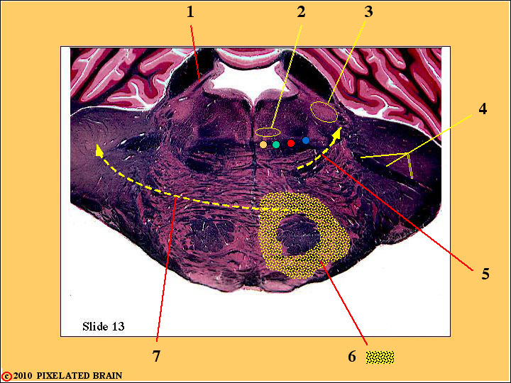 CrossSection through the Mid Pons CrossSection through the Mid Pons