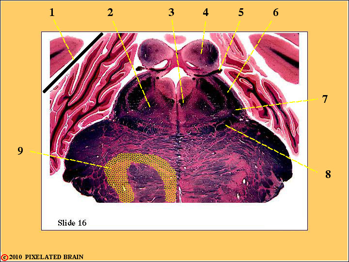 CrossSection through the Rostral Pons CrossSection through the Rostral Pons