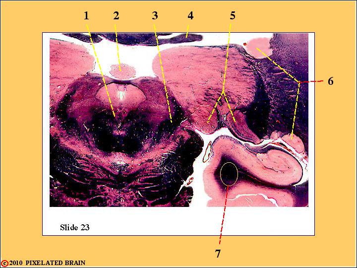  Slide 23 - Midbrain/Diencephalon 