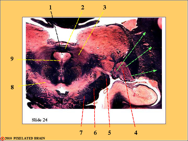 CrossSection through the Caudal Thalamus CrossSection through the Caudal Thalamus
