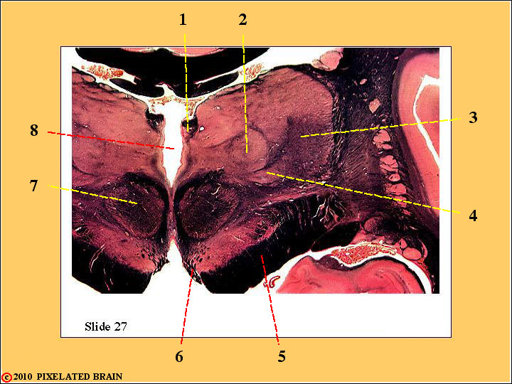  Slide 27 - Midbrain/Diencephalon 