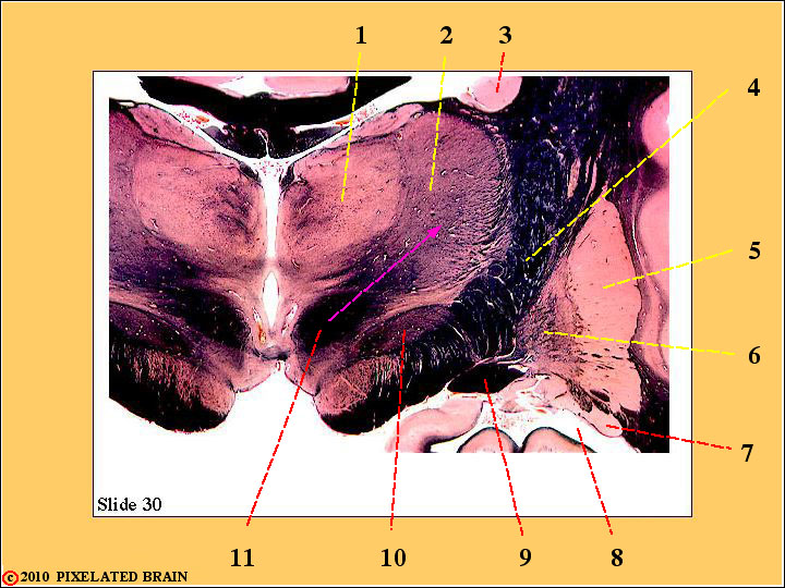 CrossSection through the Mid Thalamus CrossSection through the Mid Thalamus