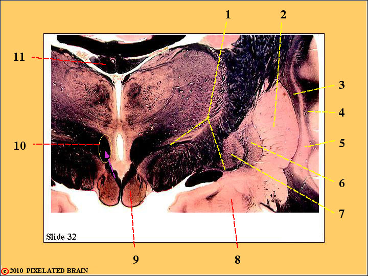  Slide 32 - the Diencephalon 