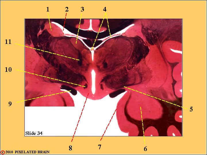  Slide 34 - the Diencephalon 