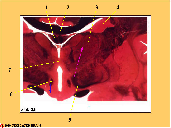  Slide 35 - the Diencephalon 