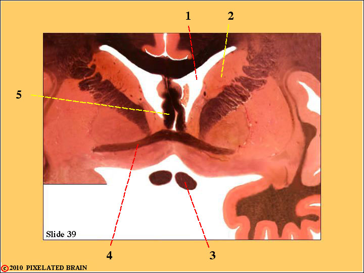  Slide 39 - the Anterior Commissure 