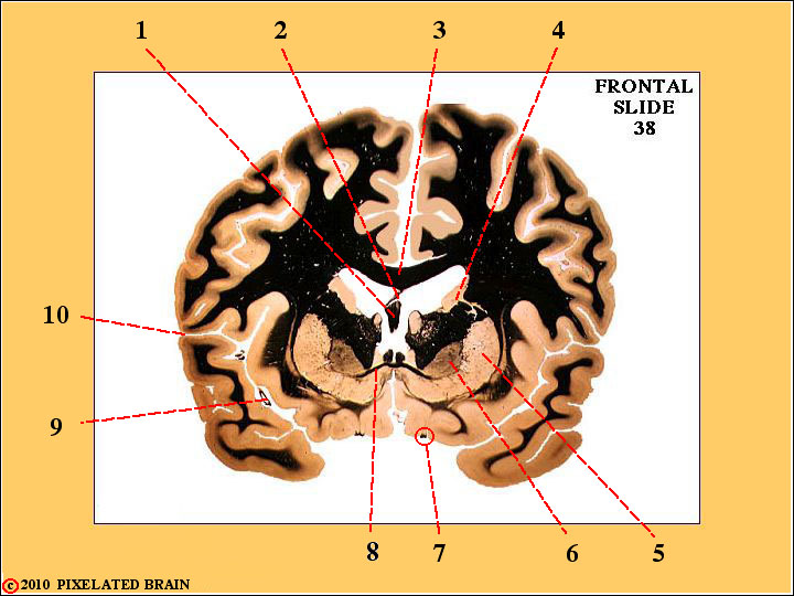 Frontal Section through the Gross Brain Frontal Section through the Gross Brain