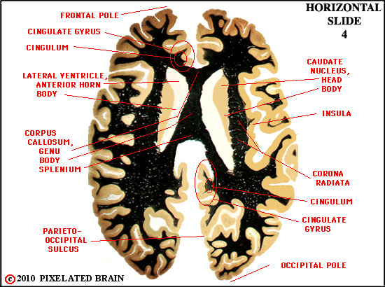 Pixelated Brain: Neuroanatomy for Medical Students